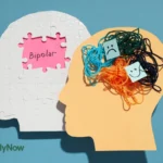 Gangguan Bipolar